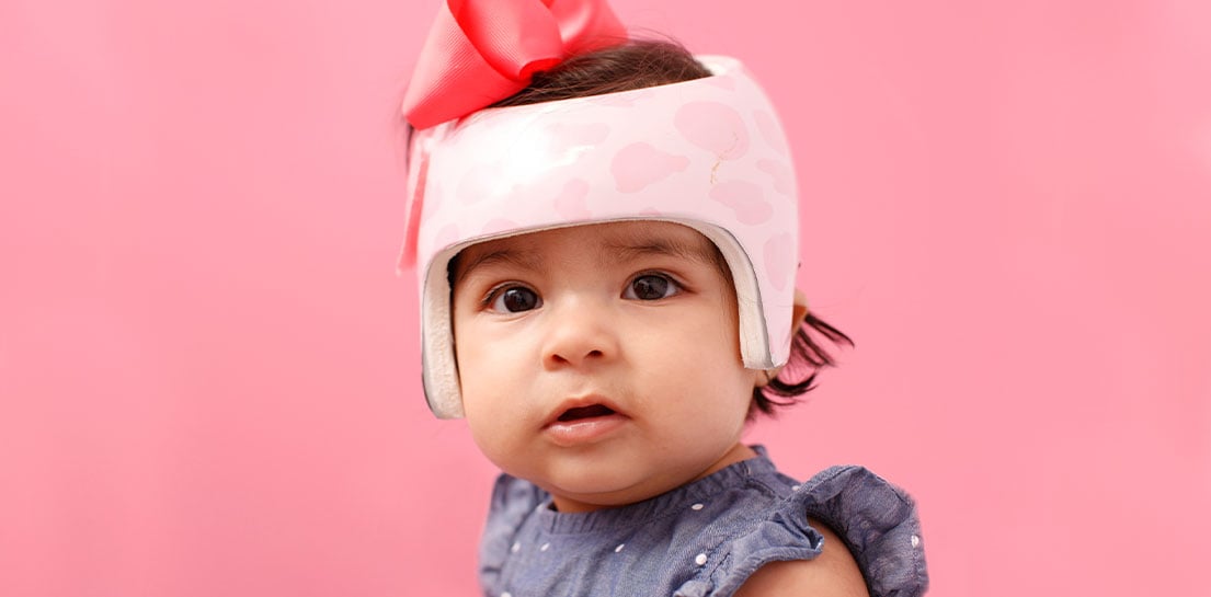 Young girl in cranial helmet